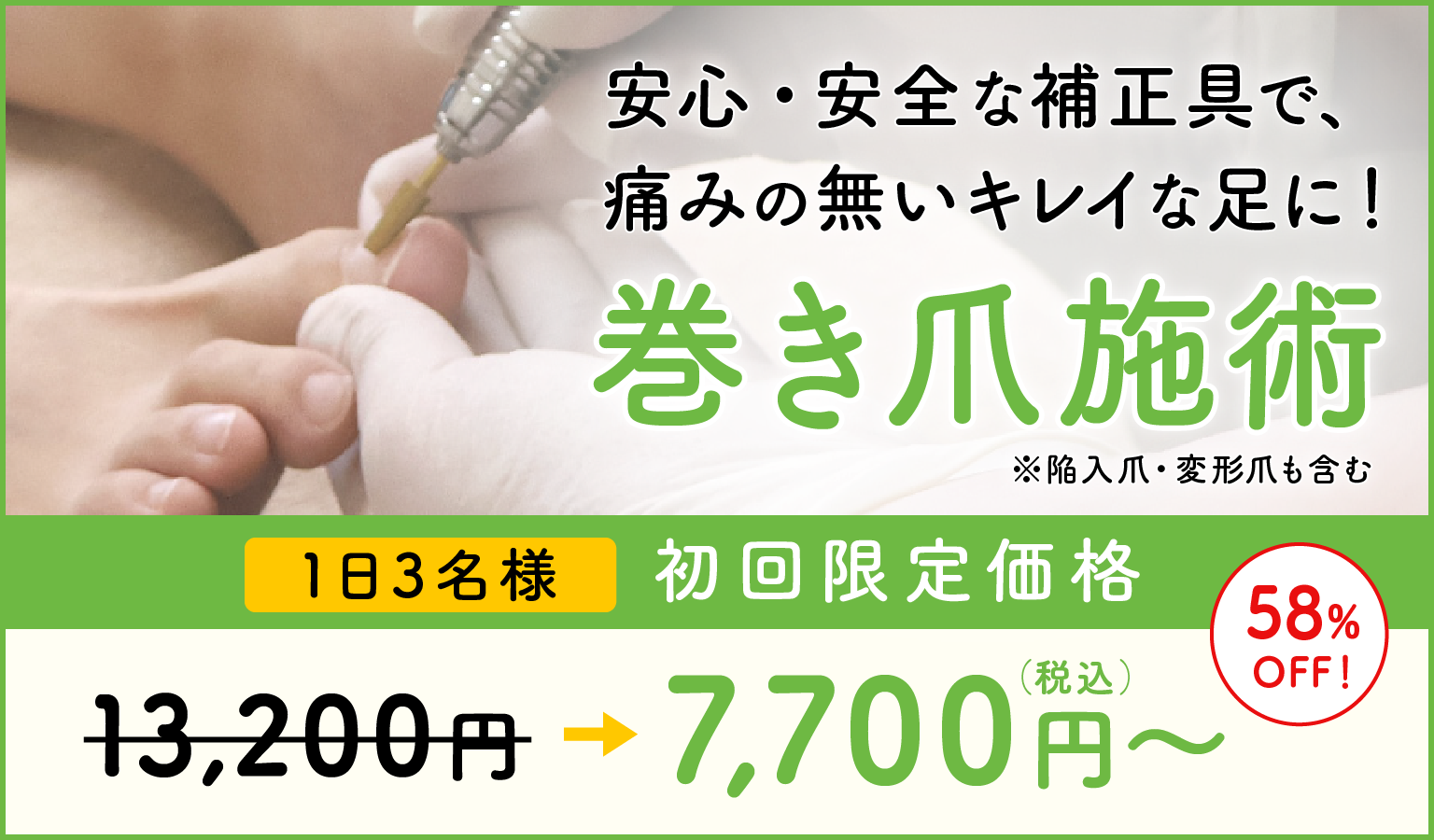 巻き爪施術 1日3名様初回限定価格 7,700円（税込）〜